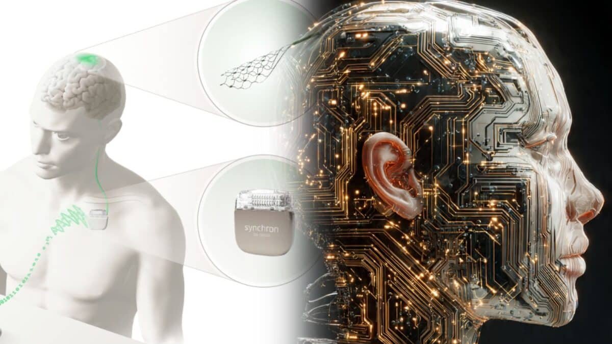 Comunidad BCI de Synchron, by Jointly